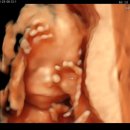 분당-19 | EP.9 임신일기_19-20주 분당제일 2차 정밀초음파, 입체초음파 후기