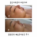 울산피부관리 비앙리에 물광윤곽 웨딩관리 받은 후기