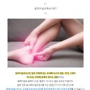 발목에 통증이 느껴진다면? 아킬레스건염 vs 발목터널증후군 이미지