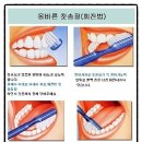 [치아성형가격 라미네이트전문] 미소천사의 비밀 치아성형 라미네이트 + 올바른 양치질 칫솔질 방법 이미지