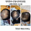 큐사랑용두점