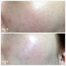 [Dr.Young] 화이트닝이 물을 만났다! 촉촉한 화이트닝 2종 체험 후기!