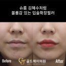 이현주치과의원 네이버블로그