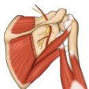 어깨통증의 숨은 주범, 극상근! 어깨충돌·오십견·가성테니스엘보의 중심 근육 이미지
