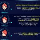 유령수술과 협진유령수술의 차이 이미지