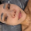 드림메디칼 | [길음] 올가뷰티드림 길음점 찐 후기: 모공보톡스 + 메디컬 관리로 지성 피부 피지 싹쓰리 (피부과...