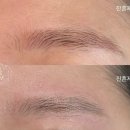 두지 | 김포 구래동 눈썹 잔흔제거 후기, 붉은 눈썹 그대로 두지 마세요 [아뮤스튜디오]