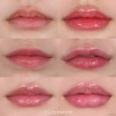 타임성형외과의원 | 와이랩 성형외과의원 박서연 원장님 리프팅 컨퍼런스