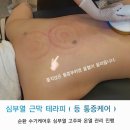 에브리바디스킨
