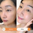 에이피 듀얼 리페어 리프트 크림 피부 탄력 살리는 리프팅 크림 솔직 사용기