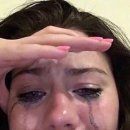 몬스터의원 | [블리비의원] 비립종제거|비립종제거가격|비립종N번째 제거하는 사람 후기 ㅋㅋ