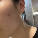 학정로 439 | 대구북구피부관리 에르모듀 수분진정관리 벨스킨 대구점