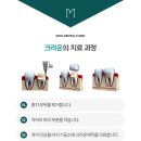 소울치과기공소 이미지