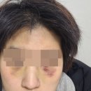 청각장애인 커플 장기간 학대하며 성범죄·금품 갈취 이미지