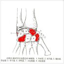 손목 터널 증후군 정리 자료 이미지