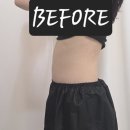 테라176 | 평택 에스테틱 밀도뷰티랩 평택｜똥배소멸 복부관리로 평택 복부관리 제대로 받은 후기