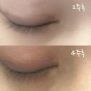 아임세림 | 내돈내산 :: 속눈썹영양제 :: Lashaddict 4주 사용 후기