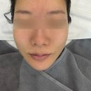 씨유 개금동원화인점 | 개금피부관리 박신옥피부연구소 | 여드름•홍조 30대예민피부 진정장벽관리 후기