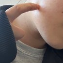 하루안치과의원 | 광교 구강악안면외과(프라자치과의원) 추천! 매복 사랑니 발치, 10일차까지 솔직 후기