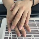 아이테오네일 이미지
