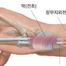 손목통증 손목 통증 원인 손목 통증 관련 손목 통증 부위 이미지