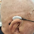 제일보청기 이미지