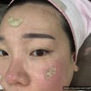 성미 | 일산 피부관리 성미스킨케어 솔직후기
