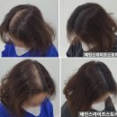 여자 출산탈모 수원 두피문신 후기