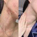 파이토신의 모든 것 효과 성분 후기 부작용