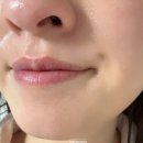 왁싱제이(WAXING JAY) | 마곡 왁싱 메리제이 웨딩촬영 인중왁싱은 필수?
