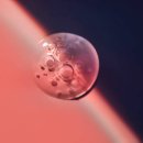 엔디어트의원 이미지