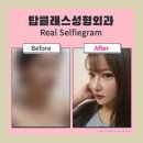 탑성형외과의원 이미지