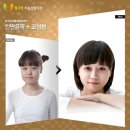 압구정서울성형외과 네이버블로그