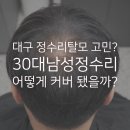 제이비종합관리 | 대구 정수리탈모 고민? 30대 남성 정수리 SMP 리얼후기 │ 미용실 추천으로 방문한 더제이비 두피문신