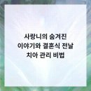 범석영치과의원 네이버블로그