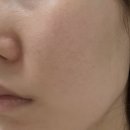 선우헬스케어 | [에센스] 속건조도 잡고 피지 각질케어와 결케어를 동시에! 믹순 콩에센스 후기