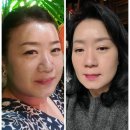 보담핏