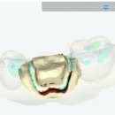 메이트치과기공소 이미지