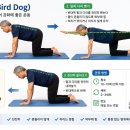 버드독 운동.척추관 햡착증 이미지
