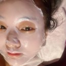 오행쑥뜸 | 봉담피부관리 오행테라피 오행쑥뜸 얼굴미백관리 대만족 후기