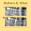 더플랜트치과의원 이미지