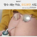 양수2 | 양수 새는 이슈로 38주 2일 유도분만 시도 후기