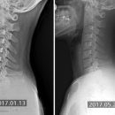 SNPE 바른자세 척추운동 이미지