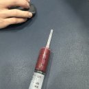 삼성본병원 | 전방십자인대 완전 파열 되다.. 반월상연골파열 시흥 정형외과 삼성본어스병원 수술 입원 후기