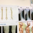 더올바로척추체형운동센터 이미지