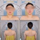 장유농협 관동지점앞 | 김해 장유 피부 및 윤관 관리에 즉각적인 효과를 주는 미선 에스테틱