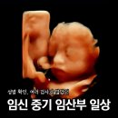 [중기임신부 일상] 15주,19주, 24주, 30주/성별확인/2차기형아검사/당뇨검사/입체초음파/원주미래산부인과