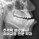 토미치과의원 | 주걱턱 비수술 치아교정 잘하는 치과 추천 TOP 5 가격 비교 정리 (2026)