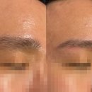동양메디칼 | 수원 페이스 왁싱 고민이라면 만족스러웠던 방문 후기