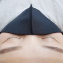 서정희피부미소